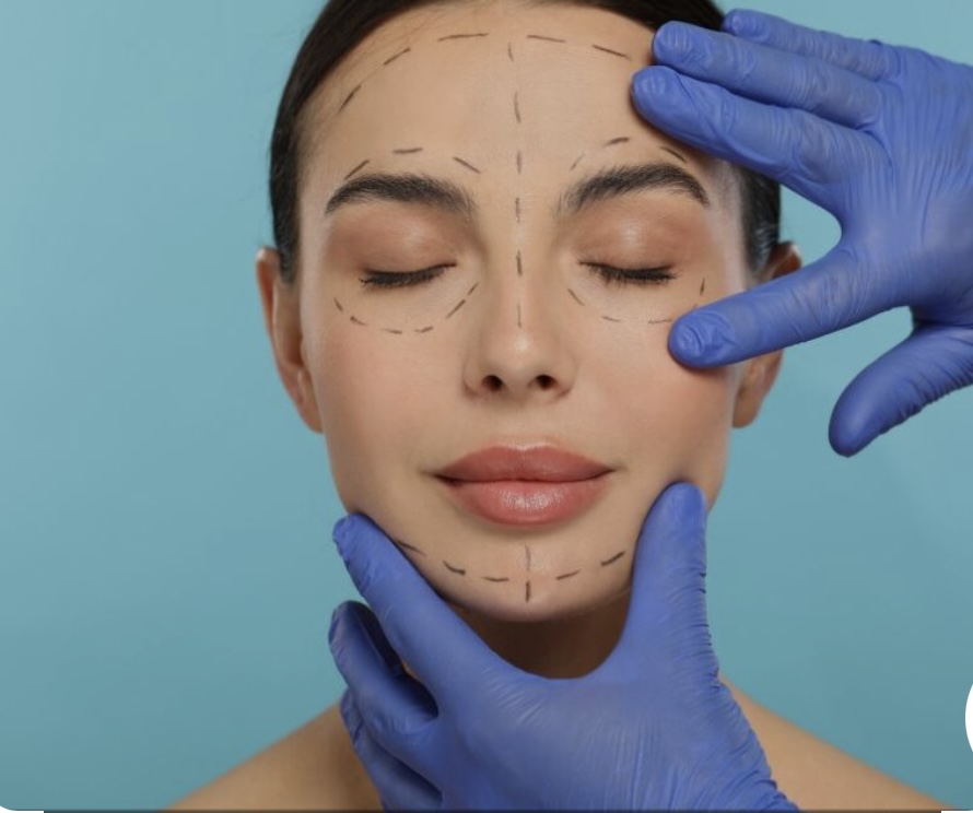 Armonizacion Facial at Dream Body Esthetic in Orlando, FL