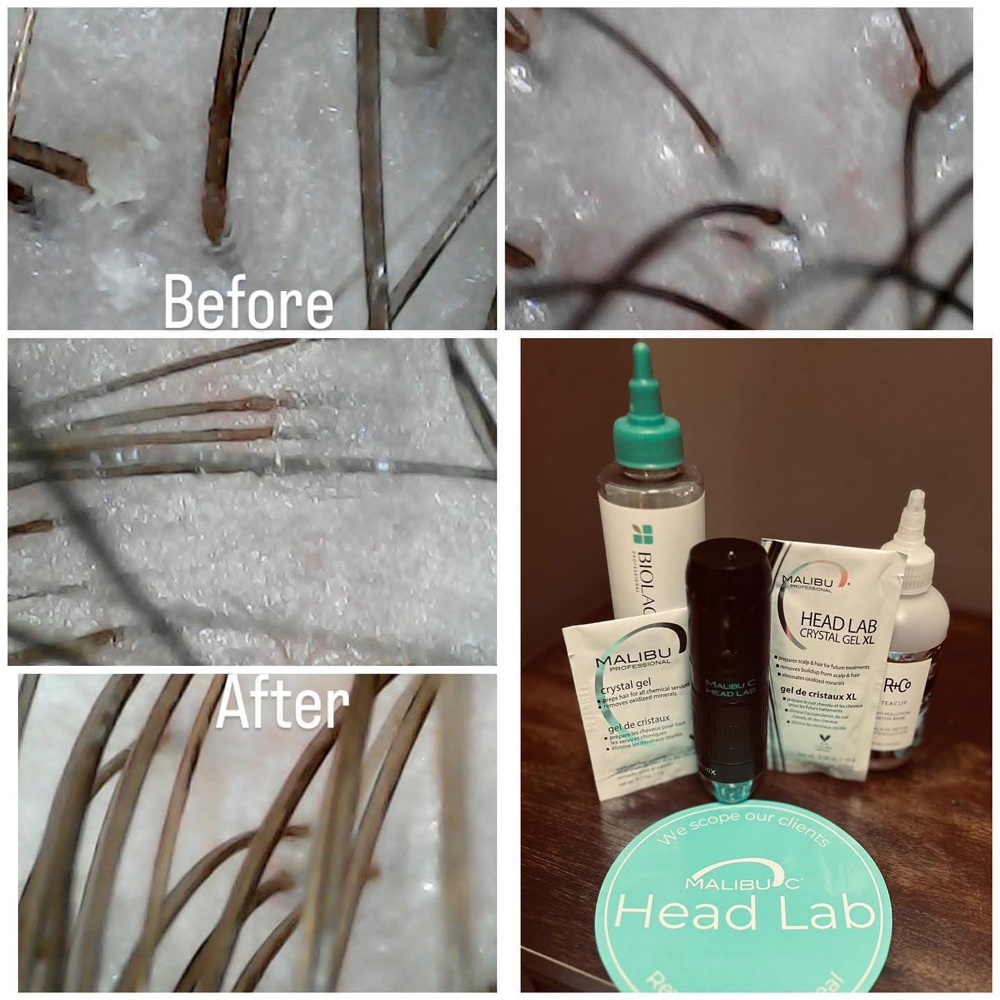 Scalp Treatment at Taya Lowell in Bay City, MI