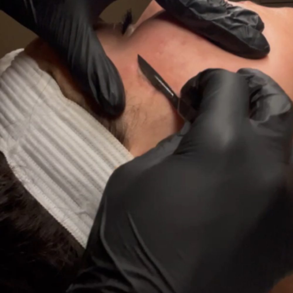 Basic Dermaplane Facials at Complexion Therapy in Kennewick, WA