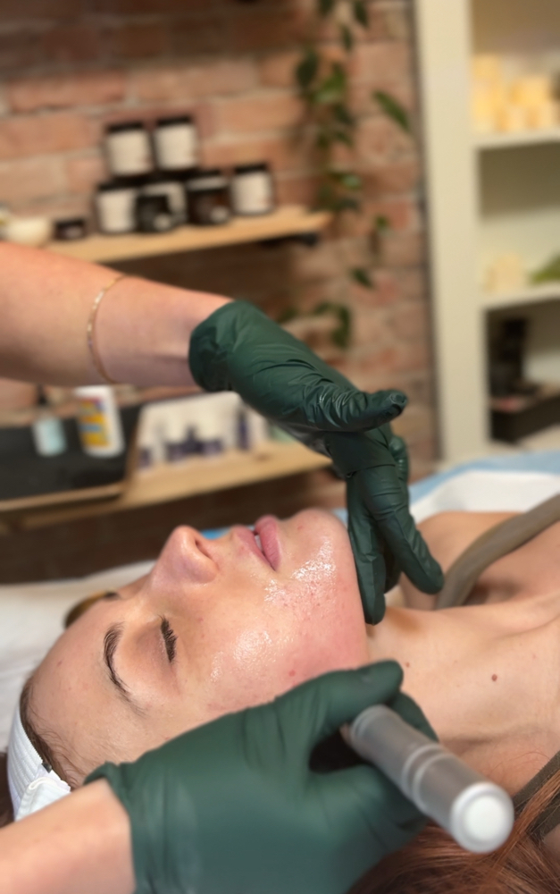 Radiance Microneedling Series