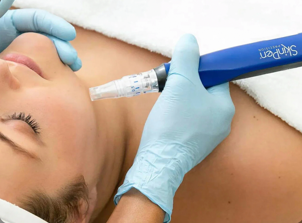 SKINPEN® MICRONEEDLING