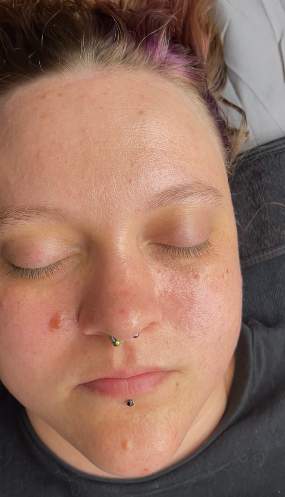 Detox Facial