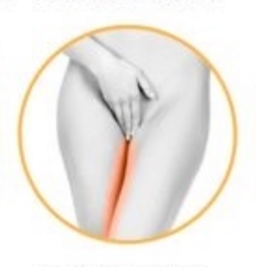 INNER THIGHS Laser Hair Removal