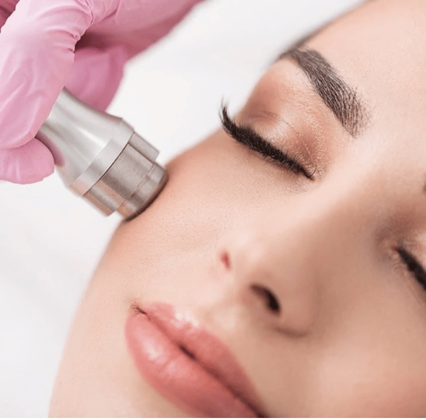 Hydro Microdermabrasion Facial