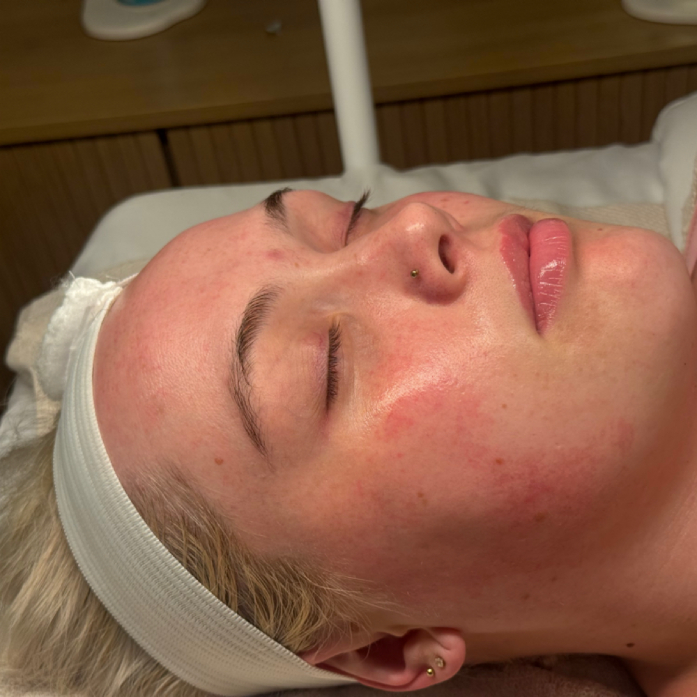 Restoring Facial 90 Minute at Skin Bar by Taya in Chico, CA