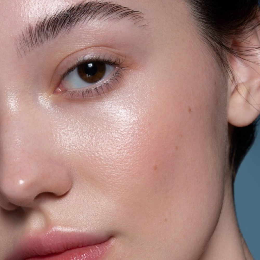 SkinPen Microneedling + Dermaplane at Alira Aesthetics in Mcallen, TX