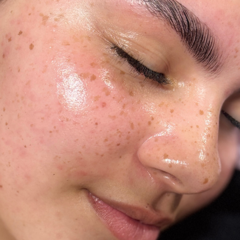 HYDRO x DERMAPLANE at Made Beauty in goodyear, AZ