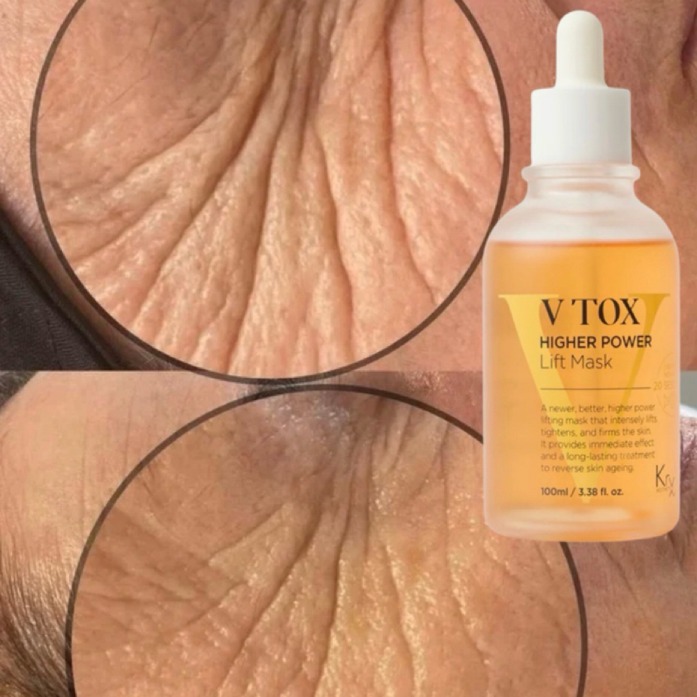 V-tox Rejuvenating Facial at Sugar Suite by Auburey Aesthetics in Scottsdale, AZ