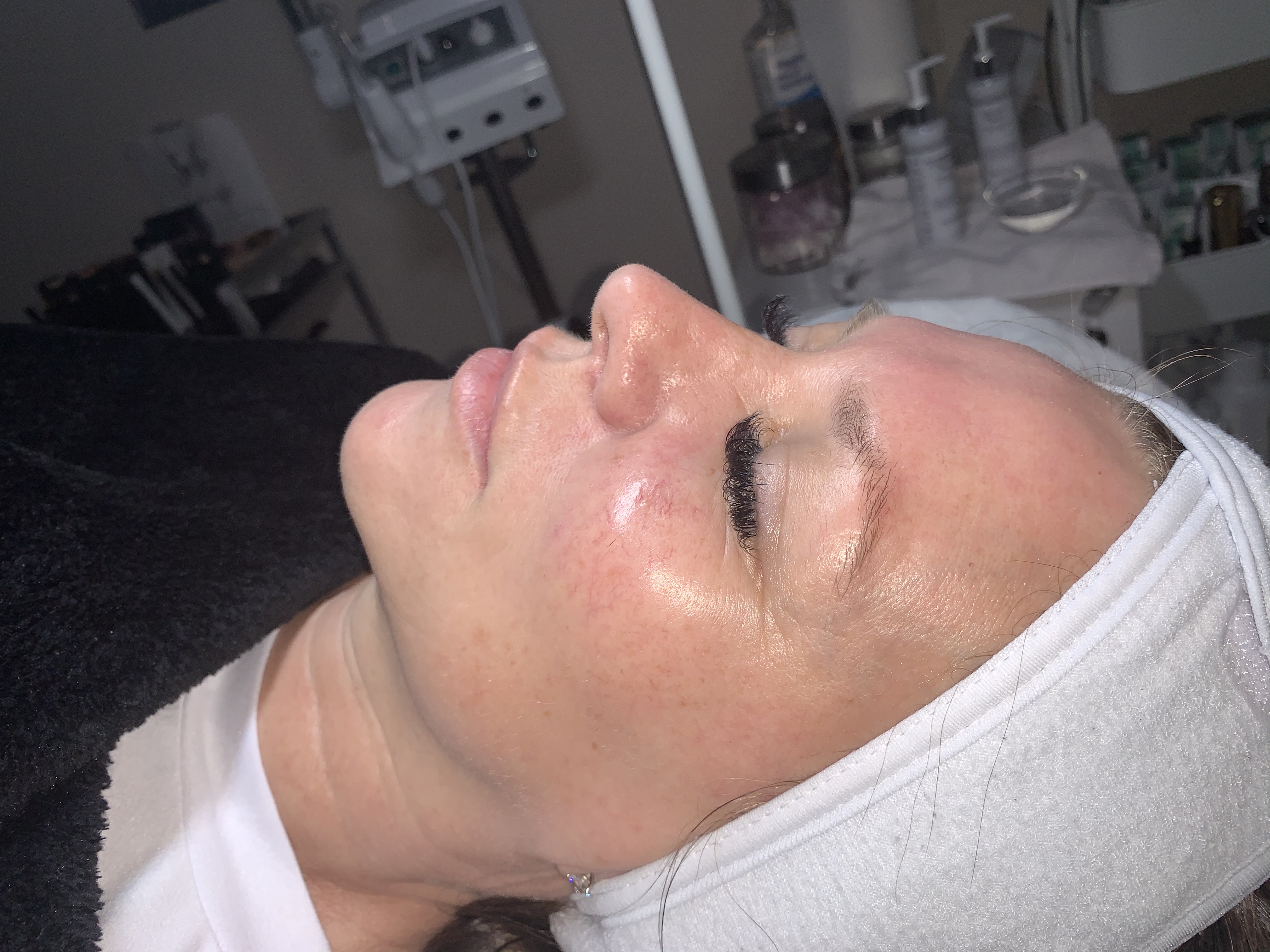 Custom Facial + Dermaplane