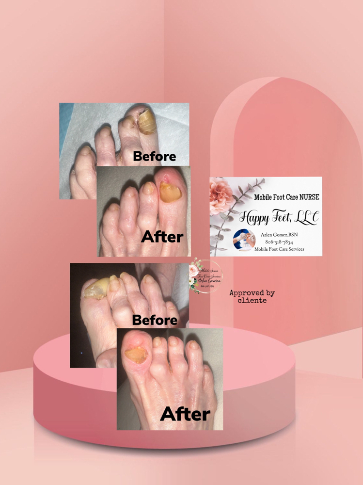 Mobile FOOTCARE SERVICES