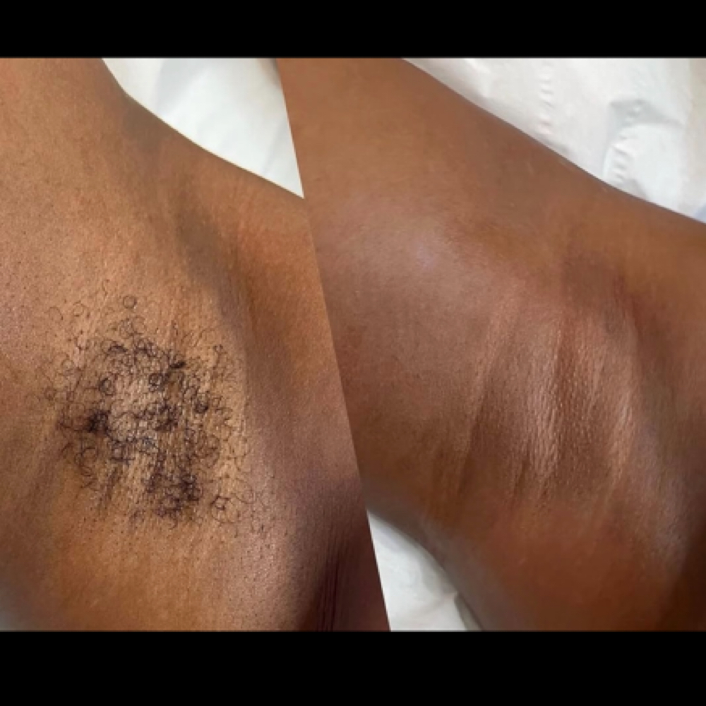 UNDERARM WAX at Kai_Esthetics in Brookfield, CT
