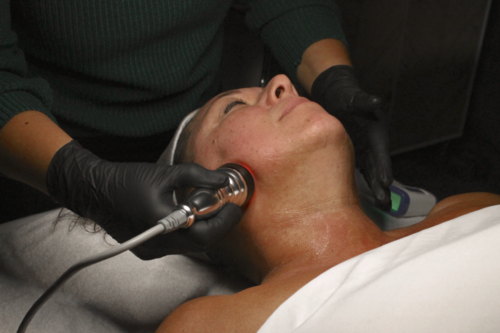 Add On RadioFrequency Therapy