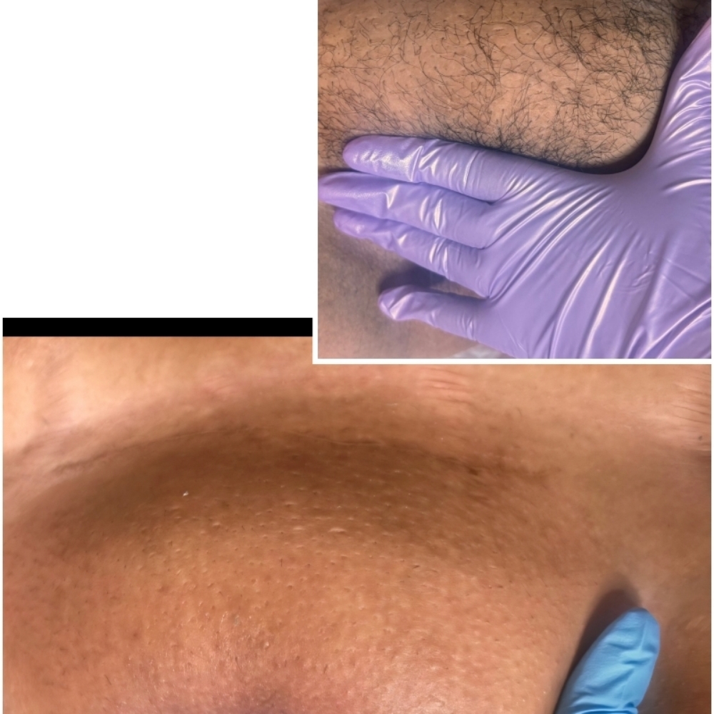 Brazilian wax at LOOK in San Bernardino, CA