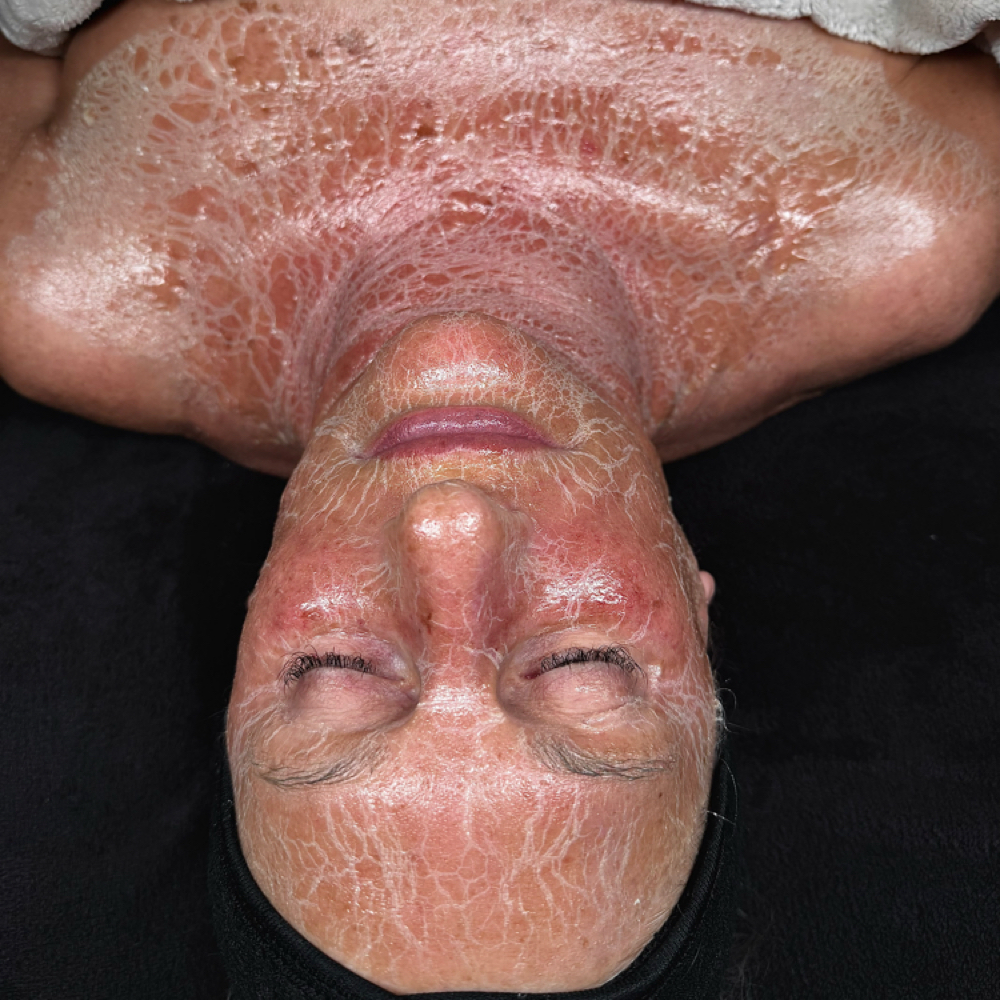 Extended Anti Aging Firming Facial at Hair Gone Wild in Belle Vernon, PA