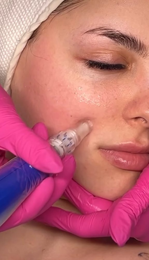 Microneedling Package Of 3