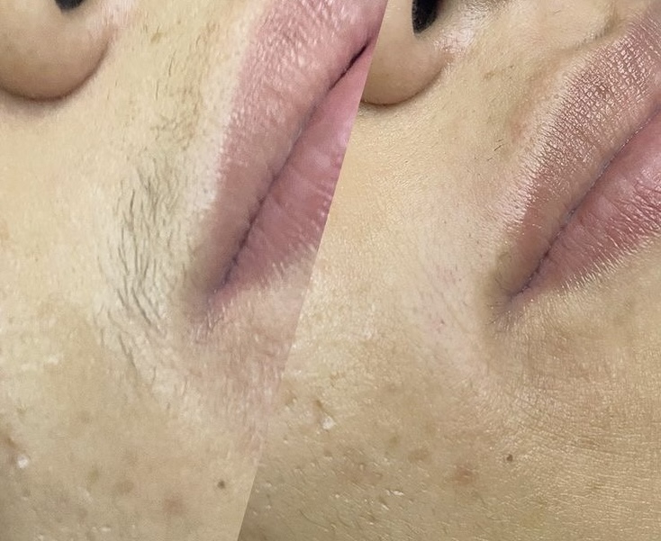 LIP + CHIN WAX