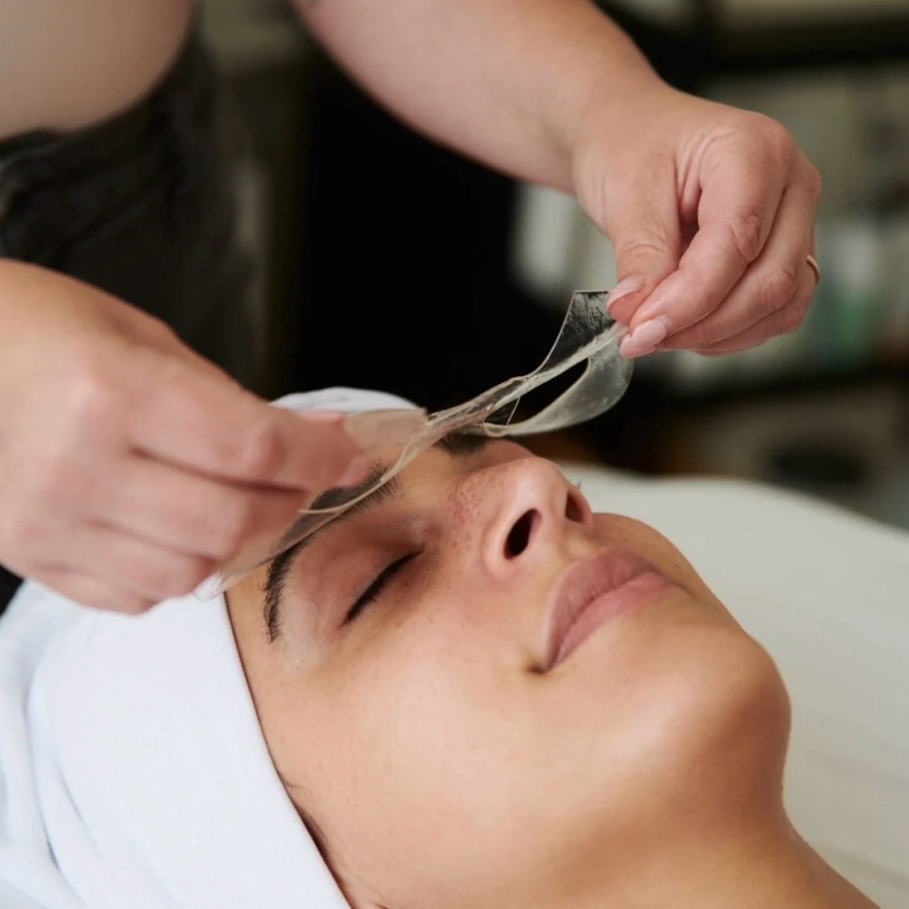 Sunburn Facial at isaaLook Esthetics in Twin Falls, ID