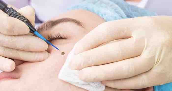 Probe Treatment