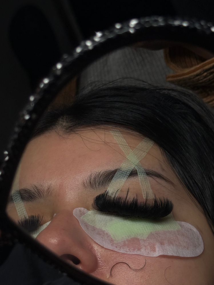 Mega Forgein Fill at Lyss Beauty Lab in Visalia, CA