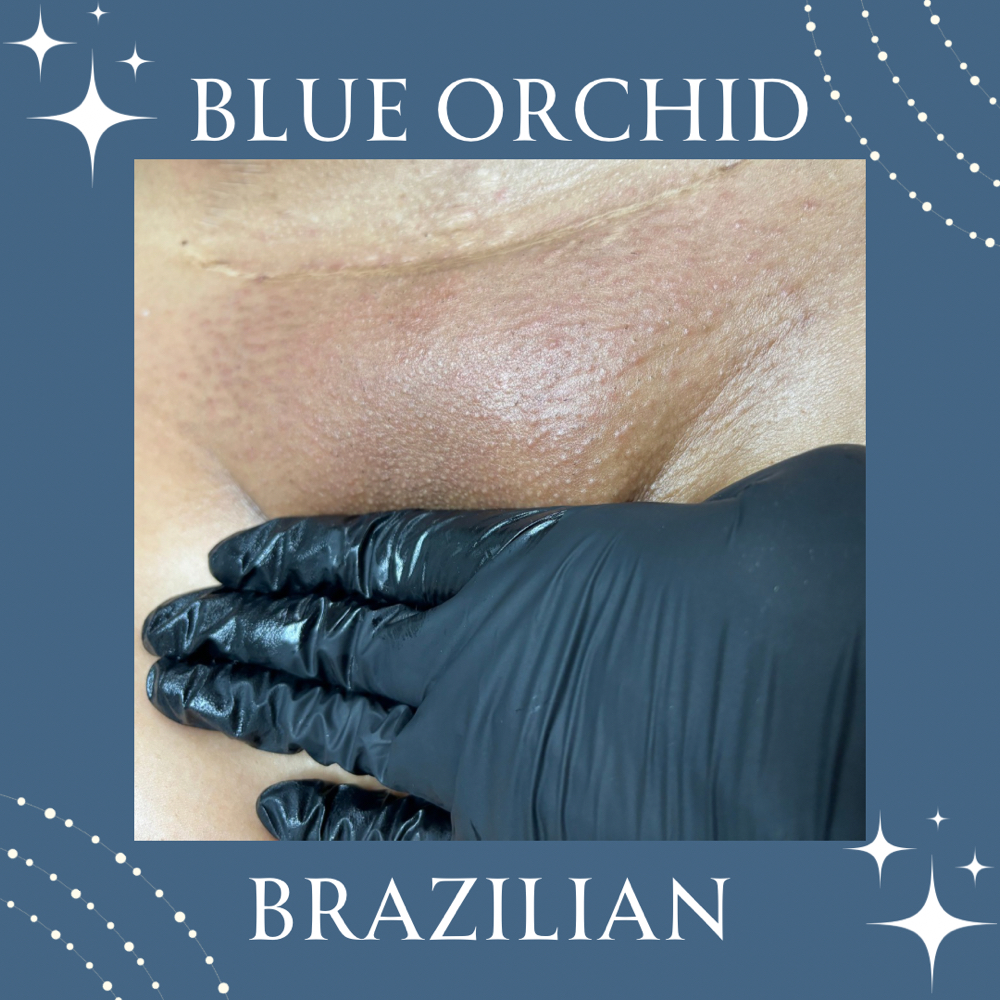 Brazillian Wax at Blue Orchid Body in Fresno, CA