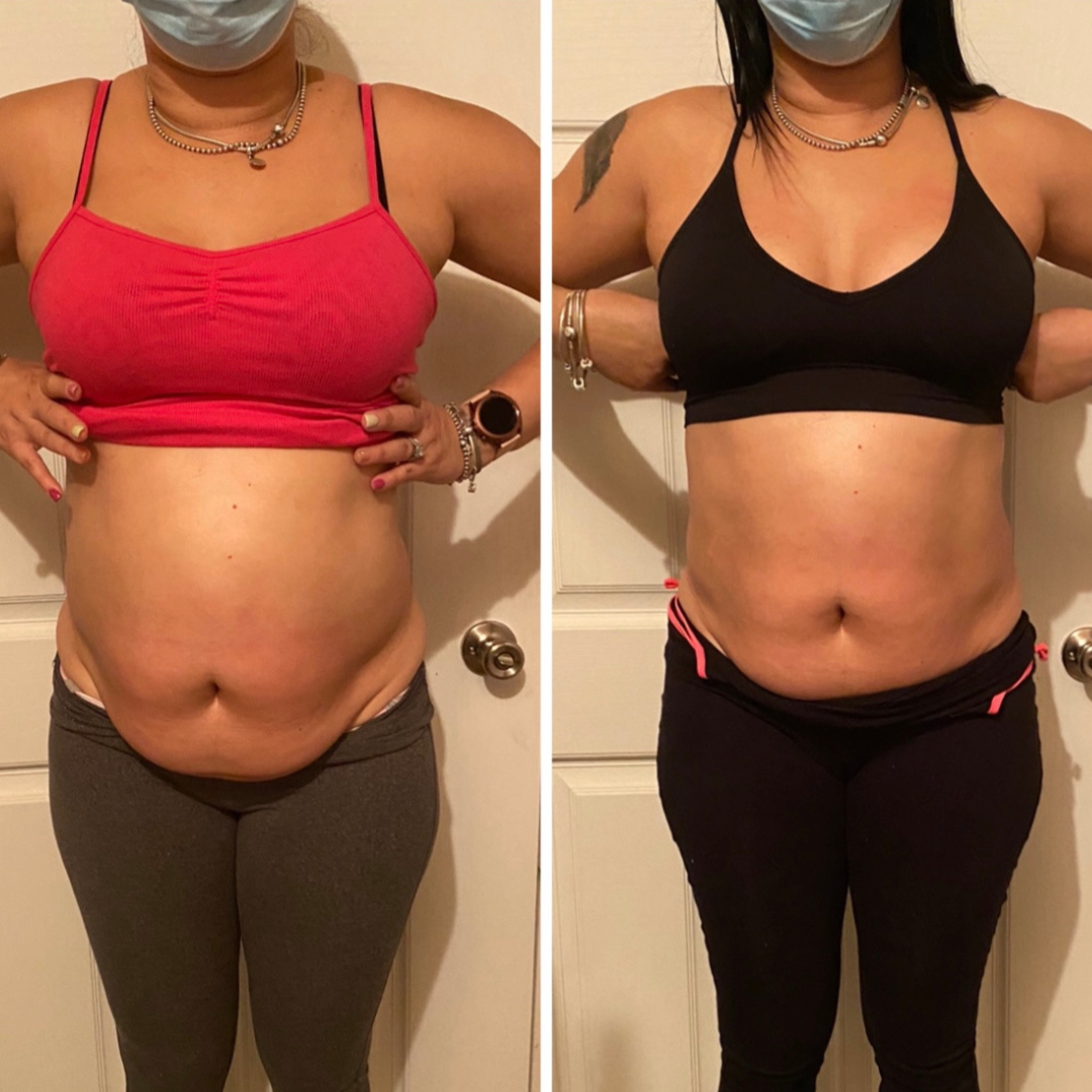 Fupa Be Gone Deal 3 for $300