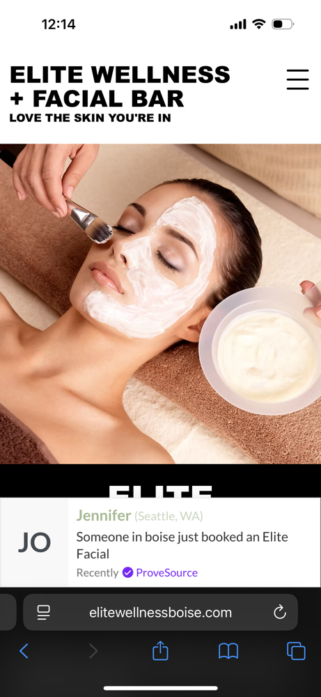 Elite Glow Microdermabrasion
