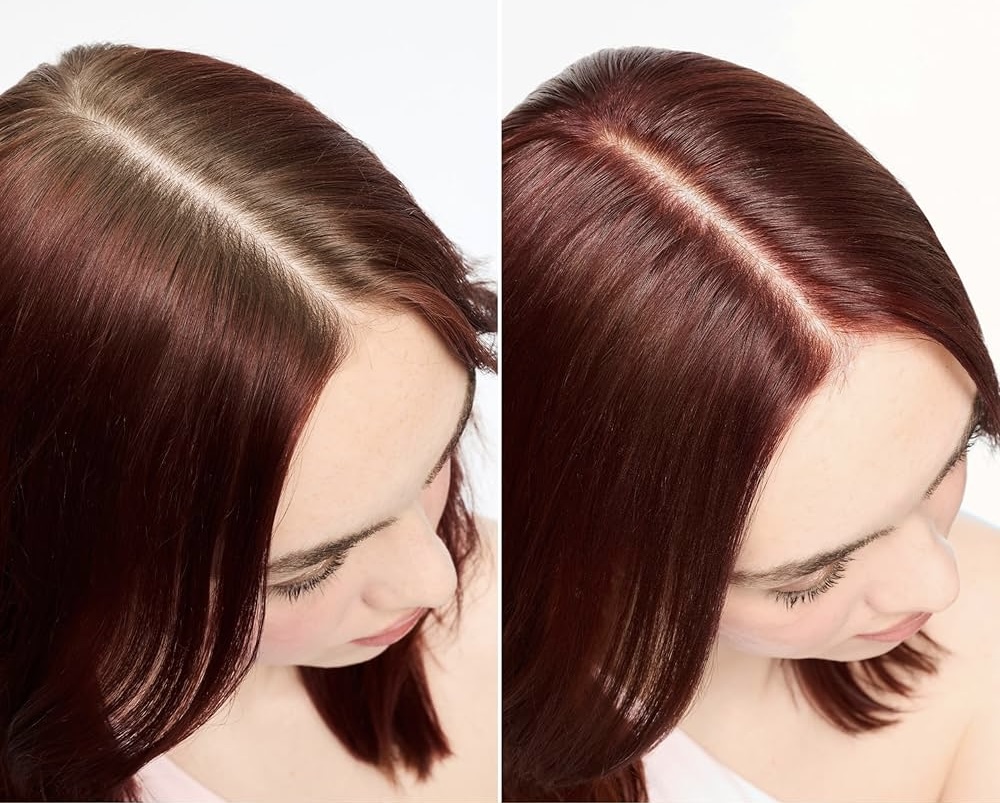 Root Re-Touch