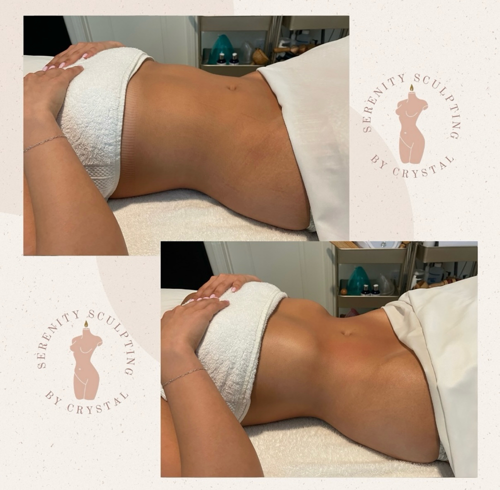 Drain & Define at Serenity Sculpting in Madera, CA