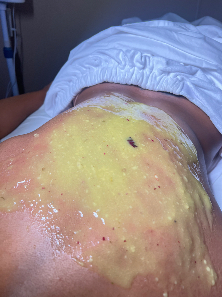 Back Jelly Mask Treatment at ๐ข๐ฑ๐ฎ๐๐ต๐ฒ๐ท๐๐ in Charlotte, NC