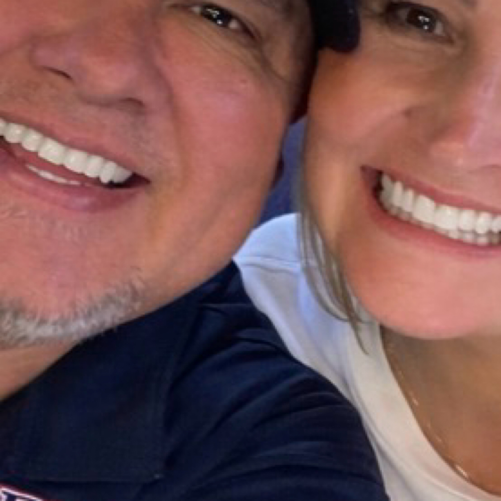 Cosmetic Teeth Whitening For Two at 1k Beauty and Wellness in FRISCO, TX