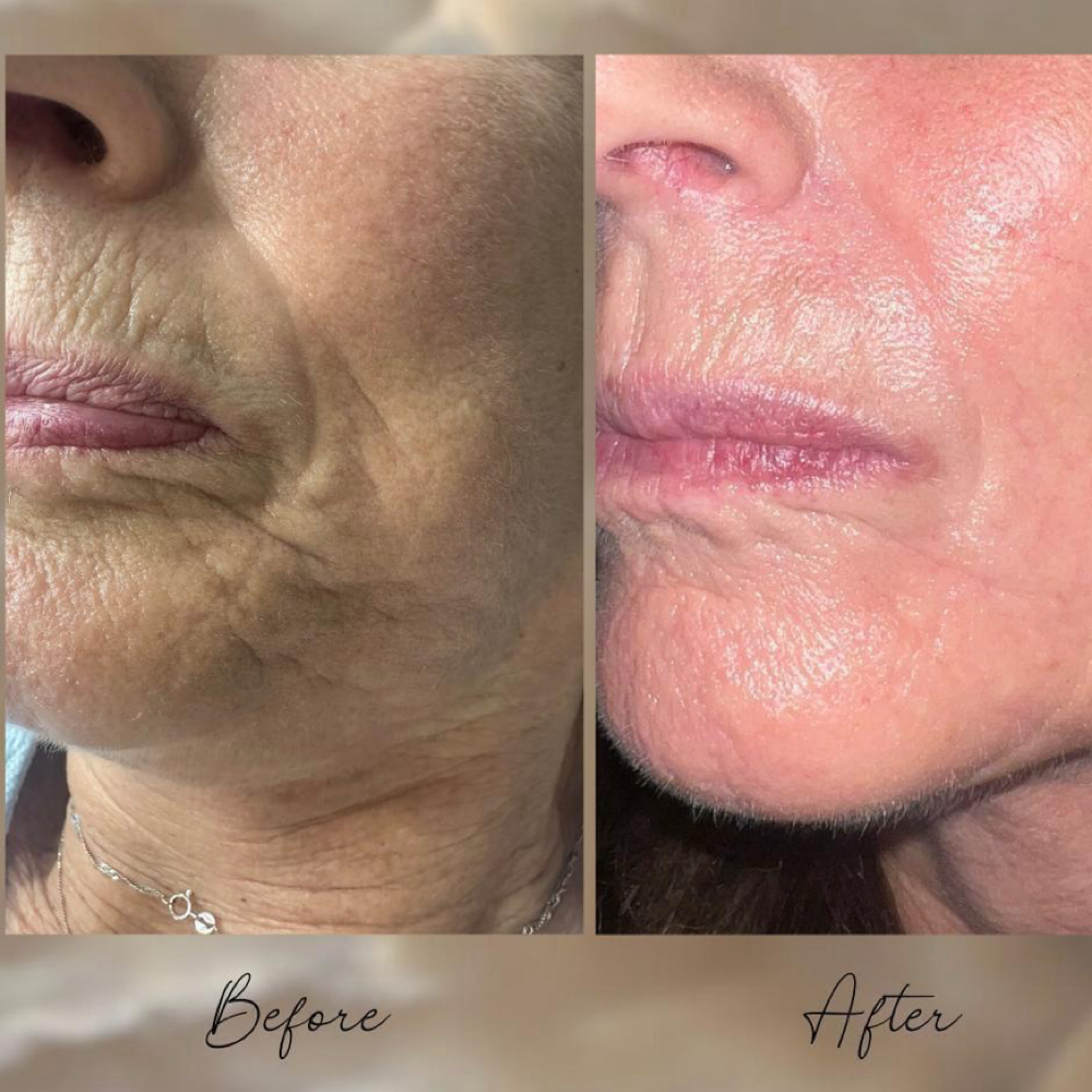 Skin Support + Enhancement at Reiss Beauty by Renée Bradlee in La Mesa, CA