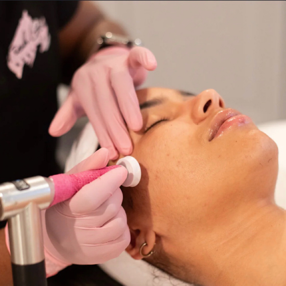 Microchanellimg FND Pckg 6 at Glow Aesthetics in Temecula, CA
