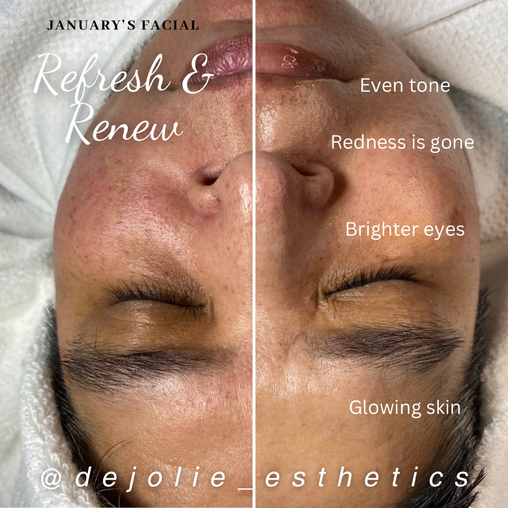 Distinctly Yours Facial Experience at DeJolie Esthetics in El Mirage, AZ