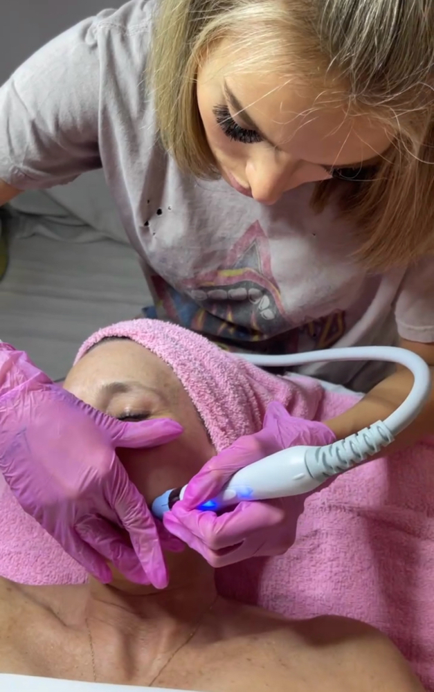 Hydrafacial