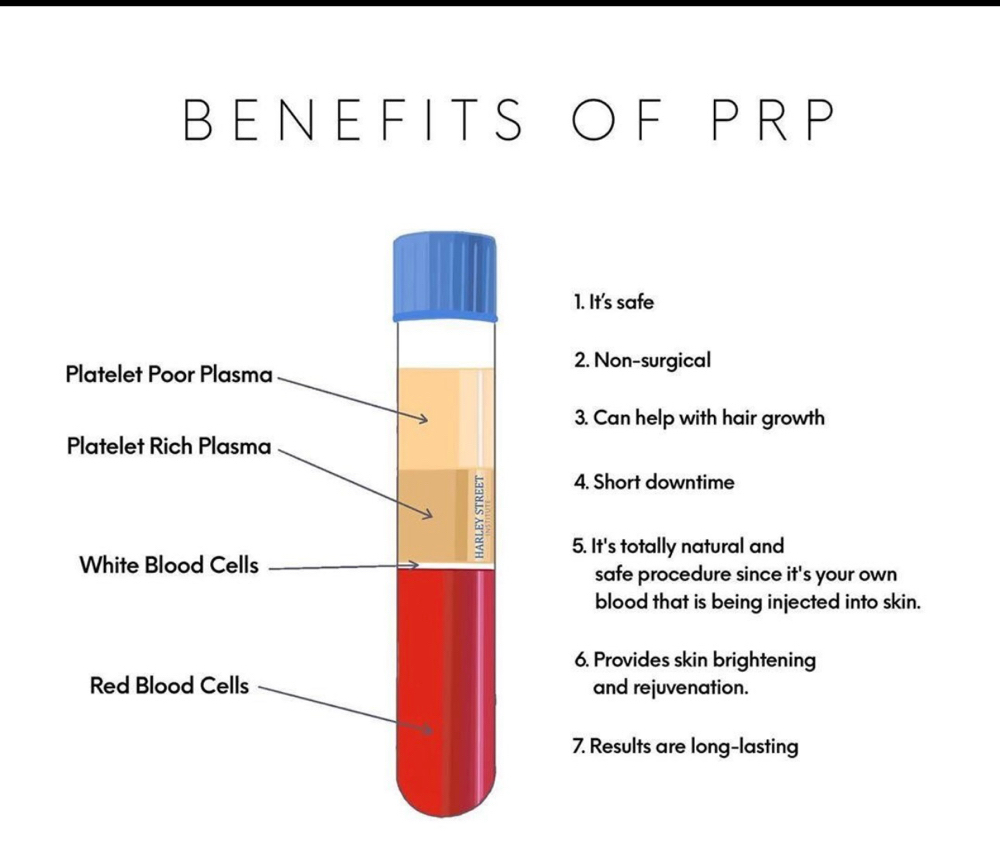 PRP With Microneedling And Vitamins