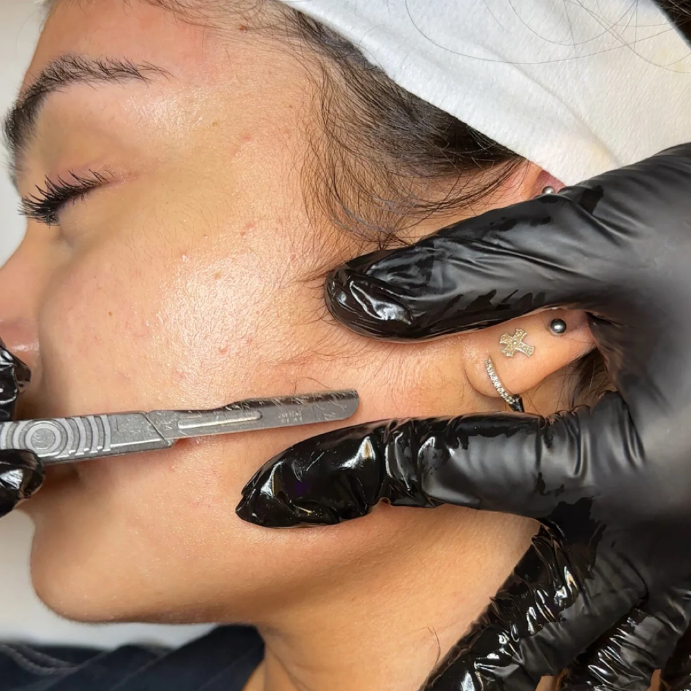 Dermaplaning Facial at Neuve Beauty in Miami, FL