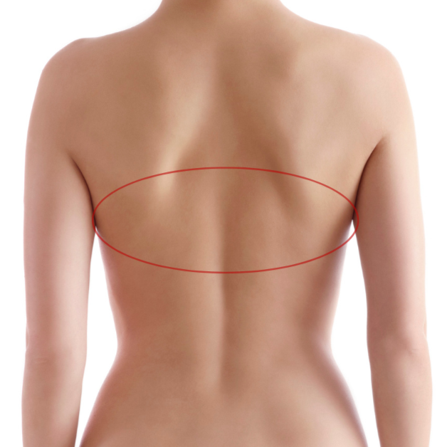 Back Mid at Bareline Aesthetics in Brea, CA