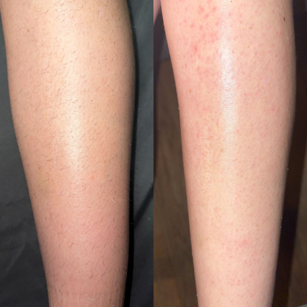 Full Leg Wax