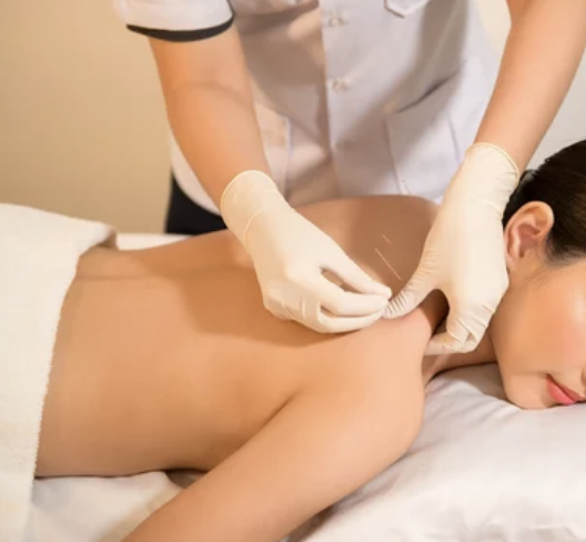 Back facial at Angel Threading and Sugar Wax Salon in Marietta, GA