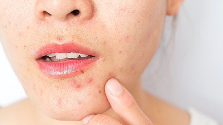 Add On-Extractions