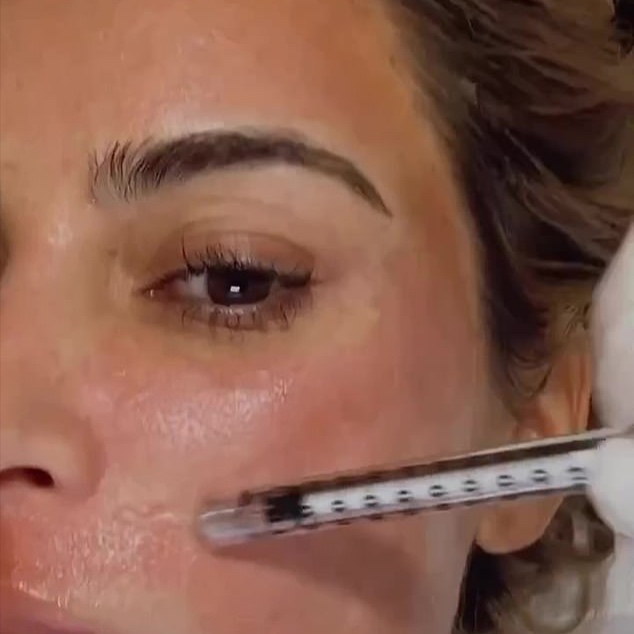 EXOSOMES FACIAL at Luxury Prime RX | #303.919.0391 in Centennial, CO