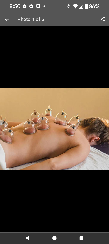 Therapeutic Cupping Massage