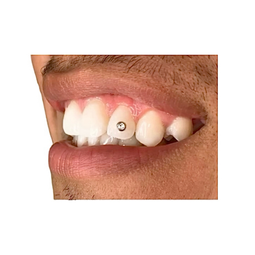 💎 .02CT #VVS CLARITYᴺᴶ at MONMOUTH COUNTYᴺᴶ ✧ 1ST TOOTH JEWELER ↯ #POPURWAXINCHERRY in Hazlet, NJ