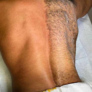 Lower Back at Hidden Beauty Wax & Spa in Arlington, TX