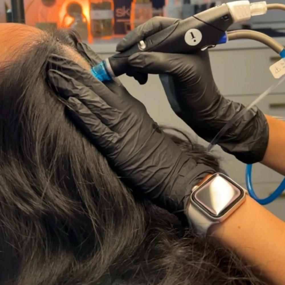 Hydro-Scalp at NKD SKN Headspa + Esthetics in Lees Summit, MO