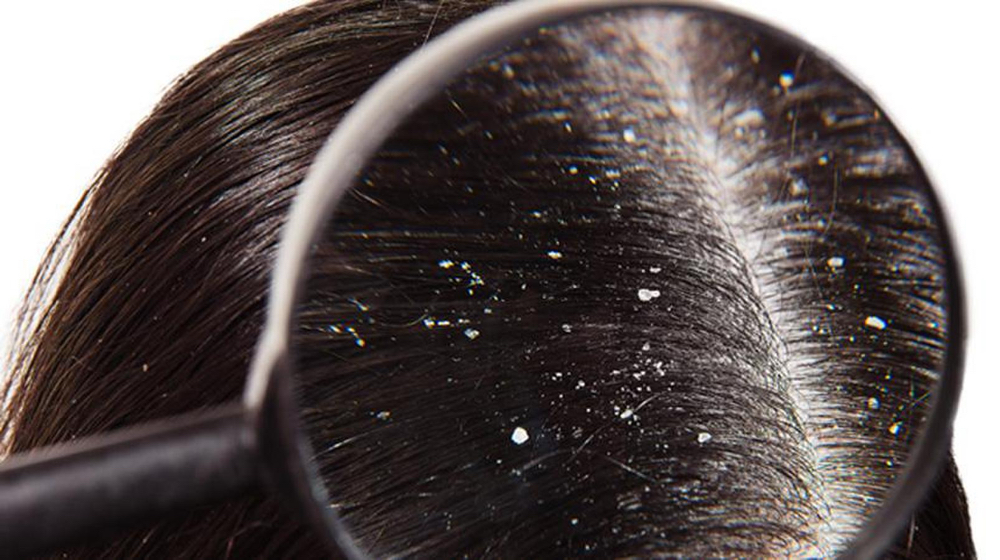 Scalp RX Therapy
