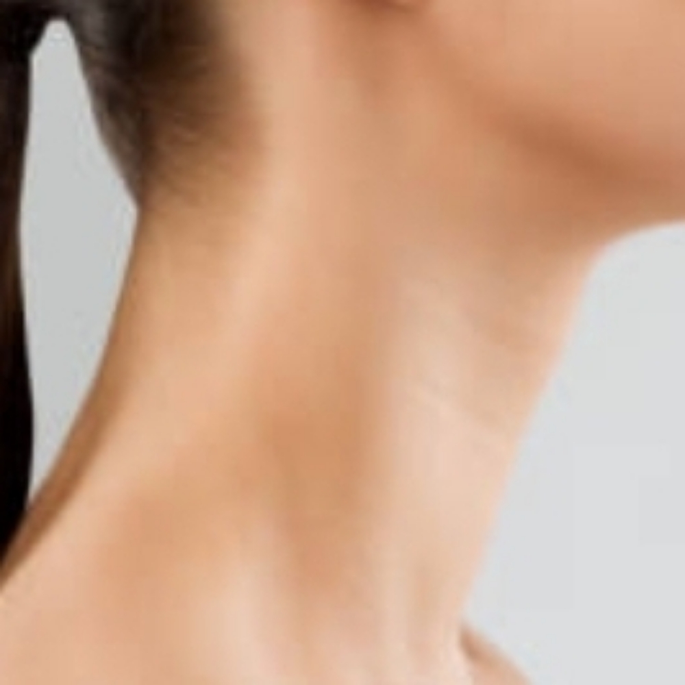 Neck at Belladonna Beauty Waxing & Skincare By Chelsea in Greenville, TX