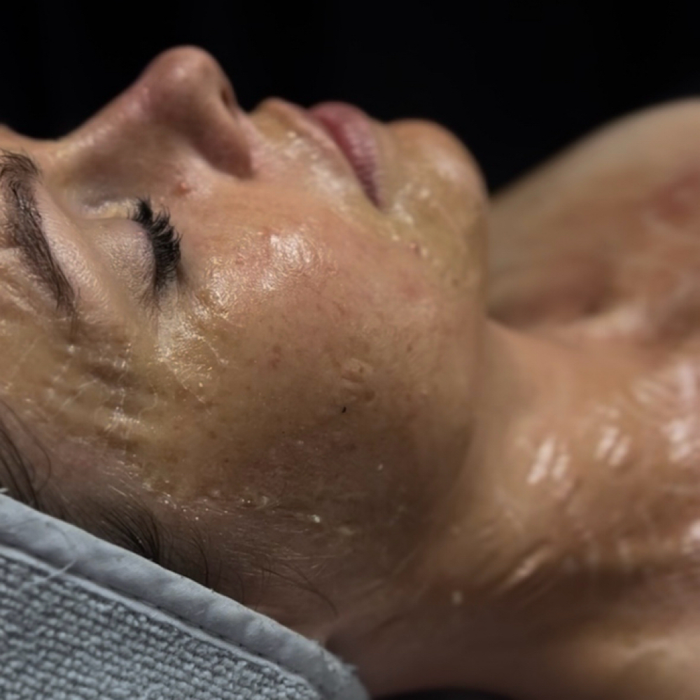 Firming Peptide Facial at June Aesthetics in Spring Hill, KS