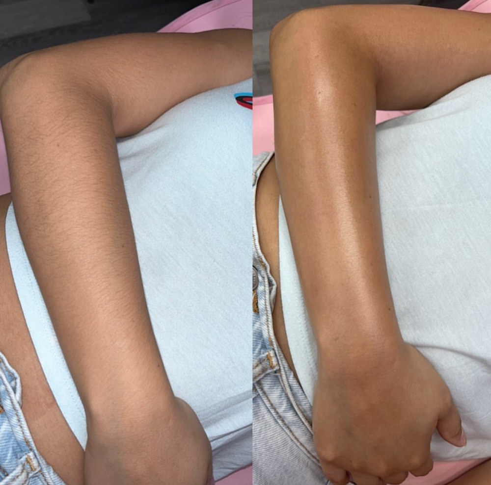 Half Arm Wax