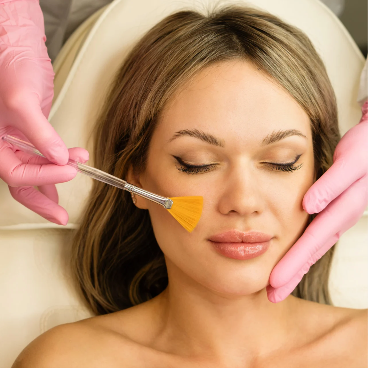 VI PEEL ADVANCED at Ultimate Solutions Medical Spa in Stamford, CT